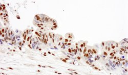 RPA32 Polyclonal Antibody, Bethyl Laboratories 10 &mu;L | Buy Online | Bethyl Laboratories, Inc | Fisher Scientific