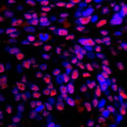 RPA32 Polyclonal Antibody, Bethyl Laboratories 10 &mu;L | Buy Online | Bethyl Laboratories, Inc | Fisher Scientific