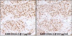 RPA70 Rabbit anti-Human, Mouse, Polyclonal, Bethyl Laboratories 100 &mu;L;