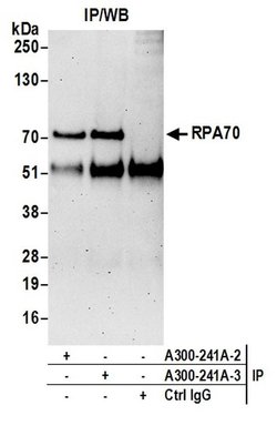RPA70 Rabbit anti-Human, Mouse, Polyclonal, Bethyl Laboratories 100 &mu;L;