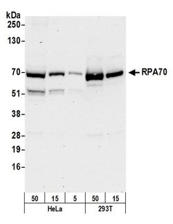 RPA70 Polyclonal Antibody, Bethyl Laboratories 20 &mu;L; Unconjugated:Antibodies,