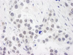 RPA70 Polyclonal Antibody, Bethyl Laboratories 10 &mu;L; Unconjugated:Antibodies,