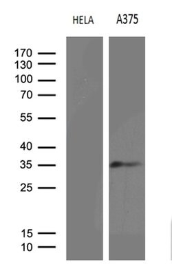 RPAIN Mouse anti-Human, Clone: OTI4F7, lyophilized, TrueMAB 100 &mu;g;