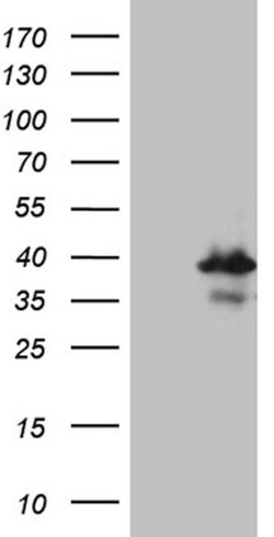 RPAIN Mouse anti-Human, Clone: OTI6A7, lyophilized, TrueMAB 100 &mu;g;