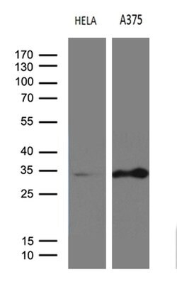 RPAIN Mouse anti-Human, Clone: OTI6A7, lyophilized, TrueMAB 100 &mu;g;
