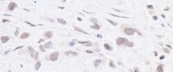 RPC2 Rabbit anti-Human, Polyclonal, Bethyl Laboratories 100 &mu;L; Unconjugated:Antibodies,