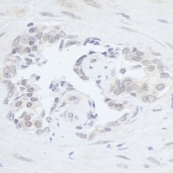 RPC2 Rabbit anti-Human, Polyclonal, Bethyl Laboratories 100 &mu;L; Unconjugated:Antibodies,