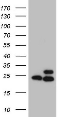 RPL10 Mouse anti-Human, Clone: OTI9A8, lyophilized, TrueMAB 100 &mu;g;