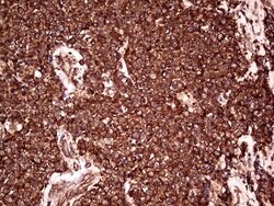 RPL10A Mouse anti-Human, Clone: OTI2G9, lyophilized, TrueMAB 100 &mu;g;
