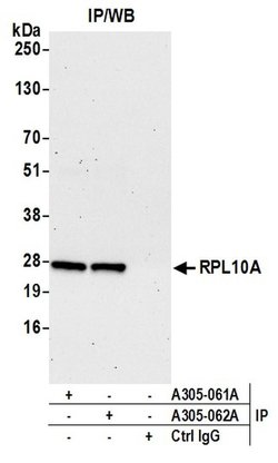 RPL10A/Ribosomal Protein L10a Rabbit anti-Human, Mouse, Polyclonal, Bethyl