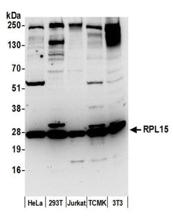 RPL15/Ribosomal Protein L15 Polyclonal Antibody, Bethyl Laboratories:Antibodies:Primary