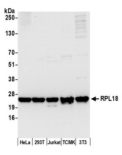 RPL18/Ribosomal Protein L18 Polyclonal Antibody, Bethyl Laboratories 20