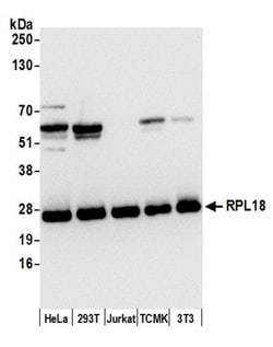RPL18/Ribosomal Protein L18 Polyclonal Antibody, Bethyl Laboratories 20