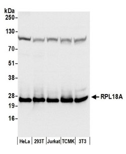 RPL18A/Ribosomal Protein L18a Polyclonal Antibody, Bethyl Laboratories 20 &mu;L | Buy Online | Bethyl Laboratories, Inc | Fisher Scientific