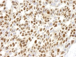 RPL26 Polyclonal Antibody, Bethyl Laboratories 100 &mu;l; Unlabeled:Antibodies,