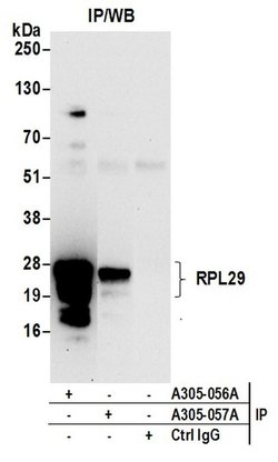 RPL29/Ribosomal Protein L29 Rabbit anti-Human, Polyclonal, Bethyl Laboratories 100 &mu;L | Buy Online | Bethyl Laboratories, Inc | Fisher Scientific