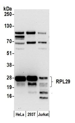 RPL29/Ribosomal Protein L29 Polyclonal Antibody, Bethyl Laboratories:Antibodies:Primary