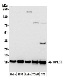 RPL30/Ribosomal Protein L30 Polyclonal Antibody, Bethyl Laboratories 20