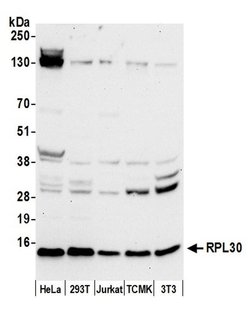 RPL30/Ribosomal Protein L30 Polyclonal Antibody, Bethyl Laboratories 20