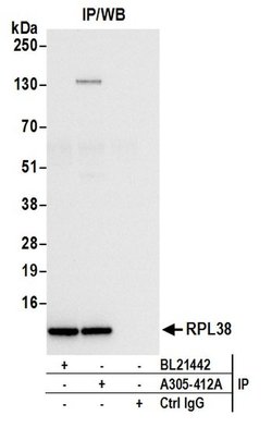 RPL38/Ribosomal Protein L38 Rabbit anti-Human, Polyclonal, Bethyl Laboratories