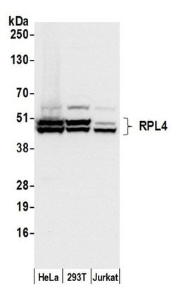 RPL4/Ribosomal Protein L4 Polyclonal Antibody, Bethyl Laboratories 20 &mu;L | Buy Online | Bethyl Laboratories, Inc | Fisher Scientific