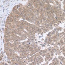 RPL5 Rabbit anti-Human, Mouse, Polyclonal, Bethyl Laboratories 100 &mu;L;