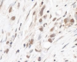 RPL5 Rabbit anti-Human, Mouse, Polyclonal, Bethyl Laboratories 100 &mu;L;