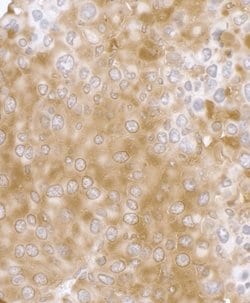 RPL7 Rabbit anti-Human, Mouse, Polyclonal, Bethyl Laboratories 100 &mu;L;