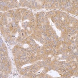 RPL7 Rabbit anti-Human, Mouse, Polyclonal, Bethyl Laboratories 100 &mu;L;