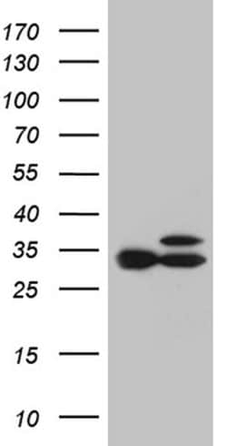 RPL7A Monoclonal Antibody (OTI4C1), TrueMAB , OriGene:Antibodies:Primary