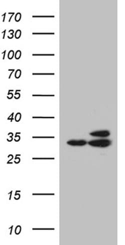 RPL7A Mouse anti-Human, Mouse, Clone: OTI3C5, lyophilized, TrueMAB 100