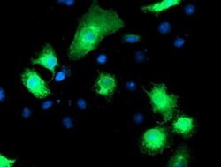 RPN1 Monoclonal Antibody (OTI6F2), TrueMAB , OriGene 100 &mu;L | Buy Online | Origene Technologies | Fisher Scientific