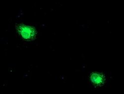 RPN1 Monoclonal Antibody (OTI5A1), TrueMAB , OriGene:Antibodies:Primary