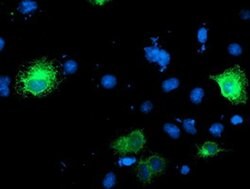 RPN1 Monoclonal Antibody (OTI6A9), TrueMAB , OriGene 100 &mu;L; Unconjugated:Antibodies,