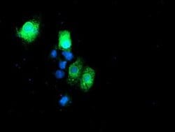RPN1 Monoclonal Antibody (OTI2G1), TrueMAB , OriGene:Antibodies:Primary
