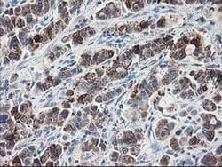 RPN1 Monoclonal Antibody (OTI3H3), TrueMAB , OriGene 30 &mu;L; Unconjugated:Antibodies,