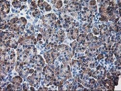 RPN1 Monoclonal Antibody (OTI3H3), TrueMAB , OriGene 30 &mu;L; Unconjugated:Antibodies,