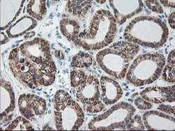 RPN1 Monoclonal Antibody (OTI3H3), TrueMAB , OriGene 30 &mu;L; Unconjugated:Antibodies,