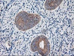 RPN1 Monoclonal Antibody (OTI3H3), TrueMAB , OriGene 30 &mu;L; Unconjugated:Antibodies,
