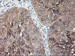 RPN1 Monoclonal Antibody (OTI3H3), TrueMAB , OriGene 30 &mu;L; Unconjugated:Antibodies,