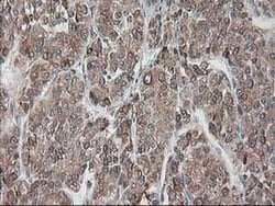 RPN1 Monoclonal Antibody (OTI3H3), TrueMAB , OriGene 30 &mu;L; Unconjugated:Antibodies,