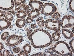RPN1 Mouse anti-Human, Rat, Clone: OTI3E1, liquid, TrueMAB 100 &mu;L; Unconjugated:Antibodies,