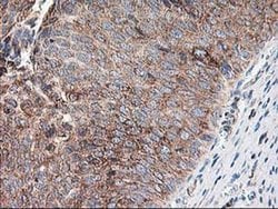 RPN1 Mouse anti-Human, Rat, Clone: OTI3E1, liquid, TrueMAB 100 &mu;L; Unconjugated:Antibodies,