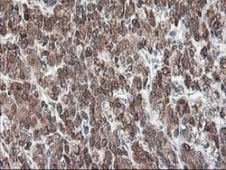 RPN1 Mouse anti-Human, Rat, Clone: OTI3E1, liquid, TrueMAB 100 &mu;L; Unconjugated:Antibodies,