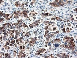 RPN1 Monoclonal Antibody (OTI6A9), TrueMAB , OriGene 100 &mu;L; Unconjugated:Antibodies,