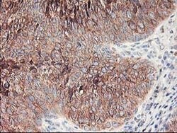 RPN1 Monoclonal Antibody (OTI6A9), TrueMAB , OriGene 100 &mu;L; Unconjugated:Antibodies,