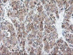 RPN1 Monoclonal Antibody (OTI6A9), TrueMAB , OriGene 100 &mu;L; Unconjugated:Antibodies,