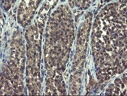 RPN1 Monoclonal Antibody (OTI5B1), TrueMAB , OriGene 100 &mu;L; Unconjugated:Antibodies,