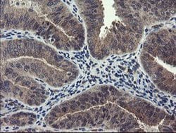 RPN1 Monoclonal Antibody (OTI5B1), TrueMAB , OriGene 100 &mu;L; Unconjugated:Antibodies,
