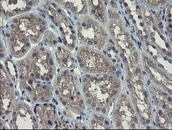 RPN1 Monoclonal Antibody (OTI5B1), TrueMAB , OriGene 100 &mu;L; Unconjugated:Antibodies,
